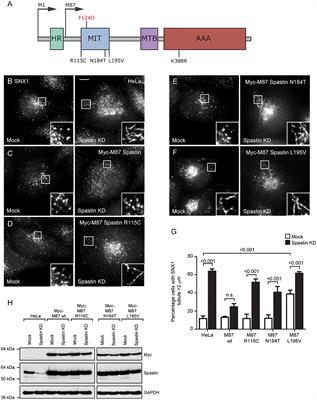 Spastin MIT Domain Disease-Associated Mutations Disrupt Lysosomal Function